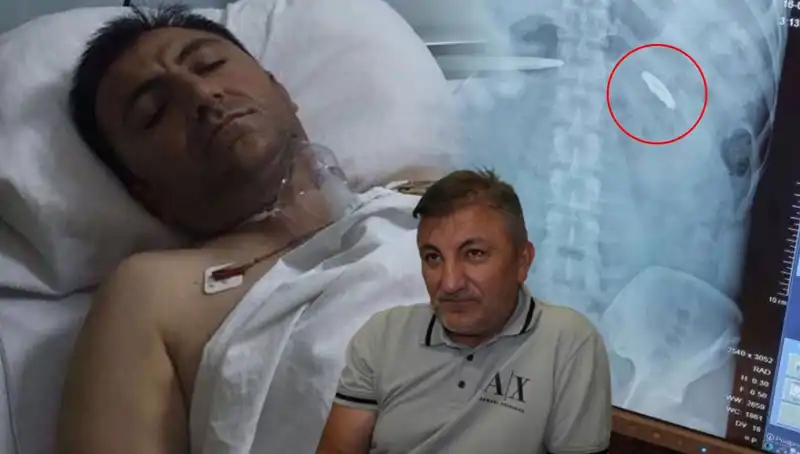 15 Temmuz'un Acı Mirası: Vücudunda Kurşunla 9 Yıl Geçiren Kahraman