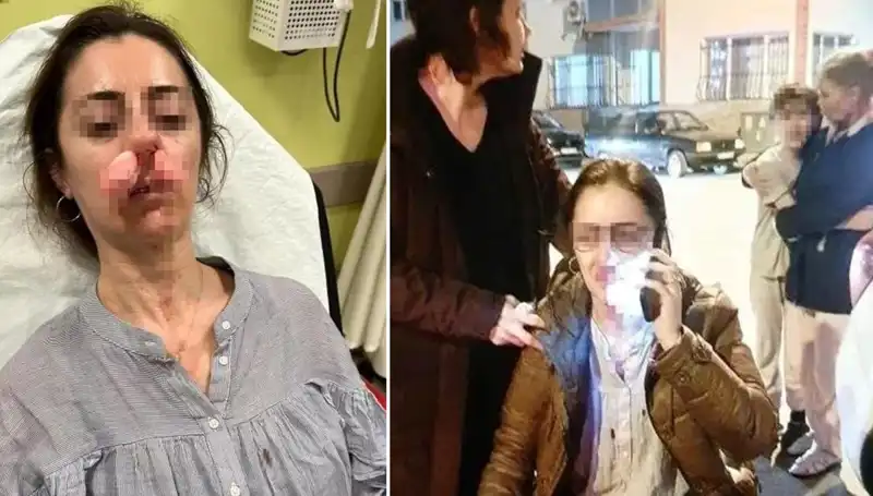 Araç Kapısı ile Yaşanan Çılgın Olay: Sevgilinin Şoku!