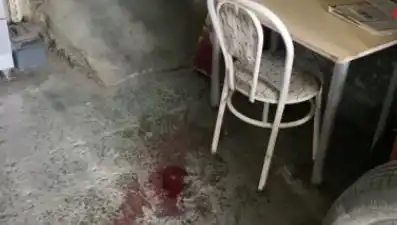 Sandalyeden Düşme Kazası: Adam Feci Şekilde Yaralandı